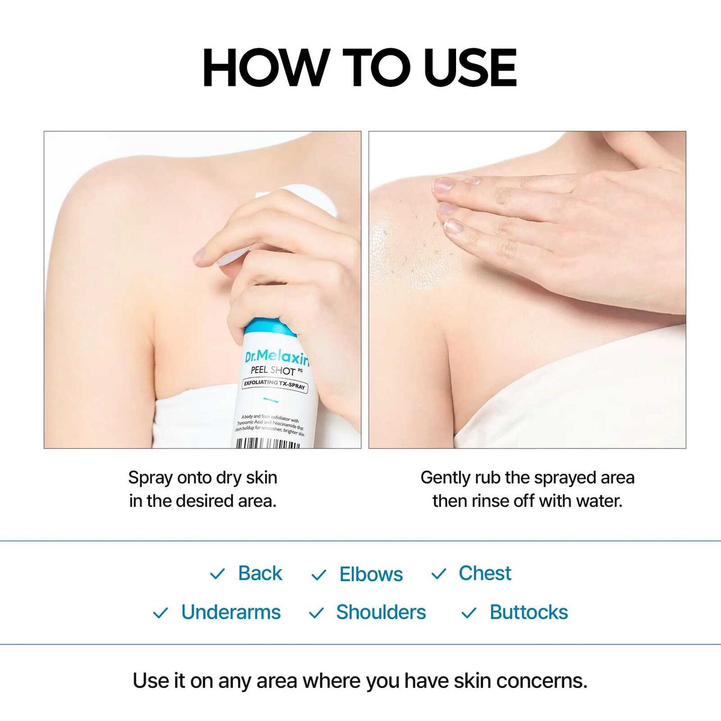 Body Resurfacing TX-Peeling Spray – Instant Dead Skin & Dark Spot Remover