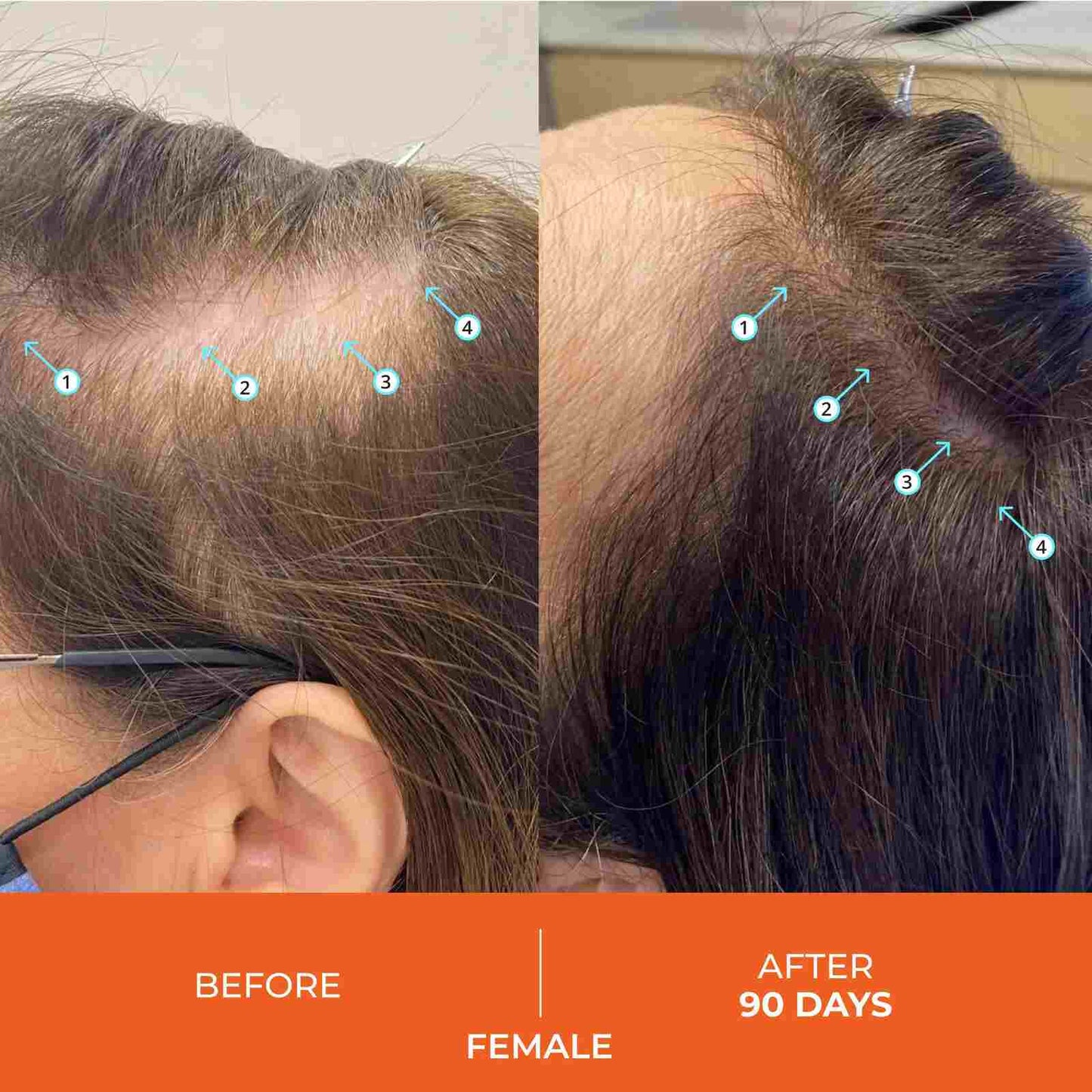 Revitalizing Hair Growth Stimulating Shampoo