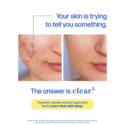 Clear Skin & Acne Support Capsules with Probiotics, DIM & Zinc