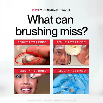 Professional Whitening Mouthwash: 8 Shades Whiter, Zero Sensitivity