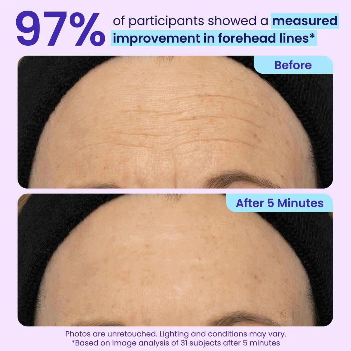 Collagen-Targeting 5-Minute Instant Lift Eye Gel: Visibly Depuff Bags & Wrinkles