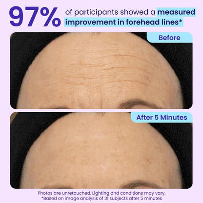 Collagen-Targeting 5-Minute Instant Lift Eye Gel: Visibly Depuff Bags & Wrinkles
