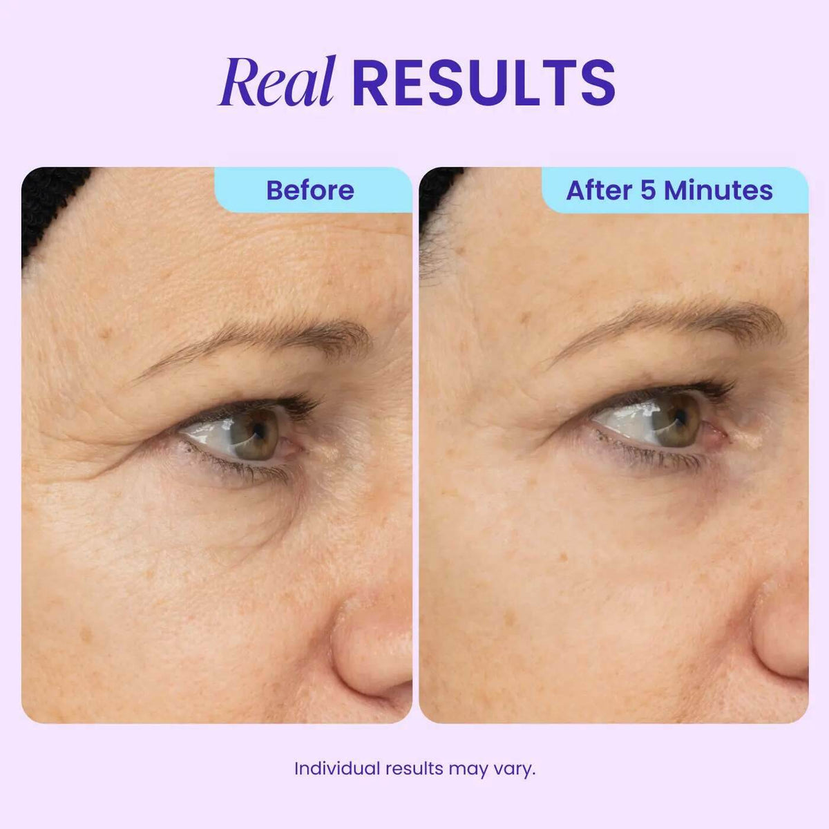 Collagen-Targeting 5-Minute Instant Lift Eye Gel: Visibly Depuff Bags & Wrinkles