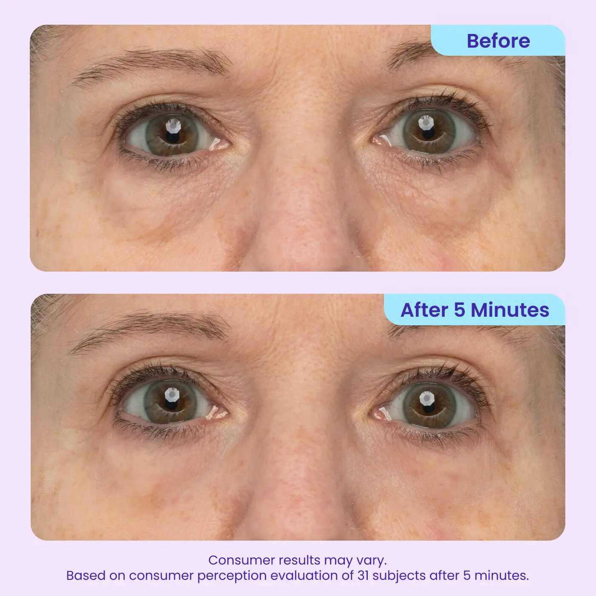 Collagen-Targeting 5-Minute Instant Lift Eye Gel: Visibly Depuff Bags & Wrinkles