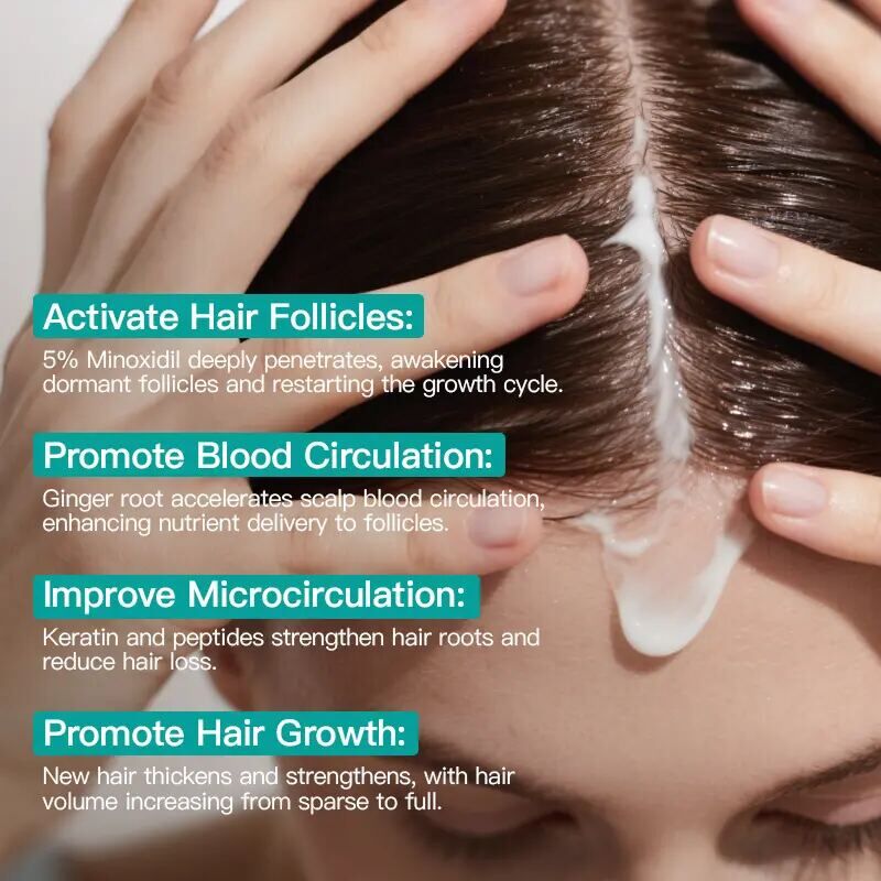 5% Minoxidil Hair Growth Scalp Cream