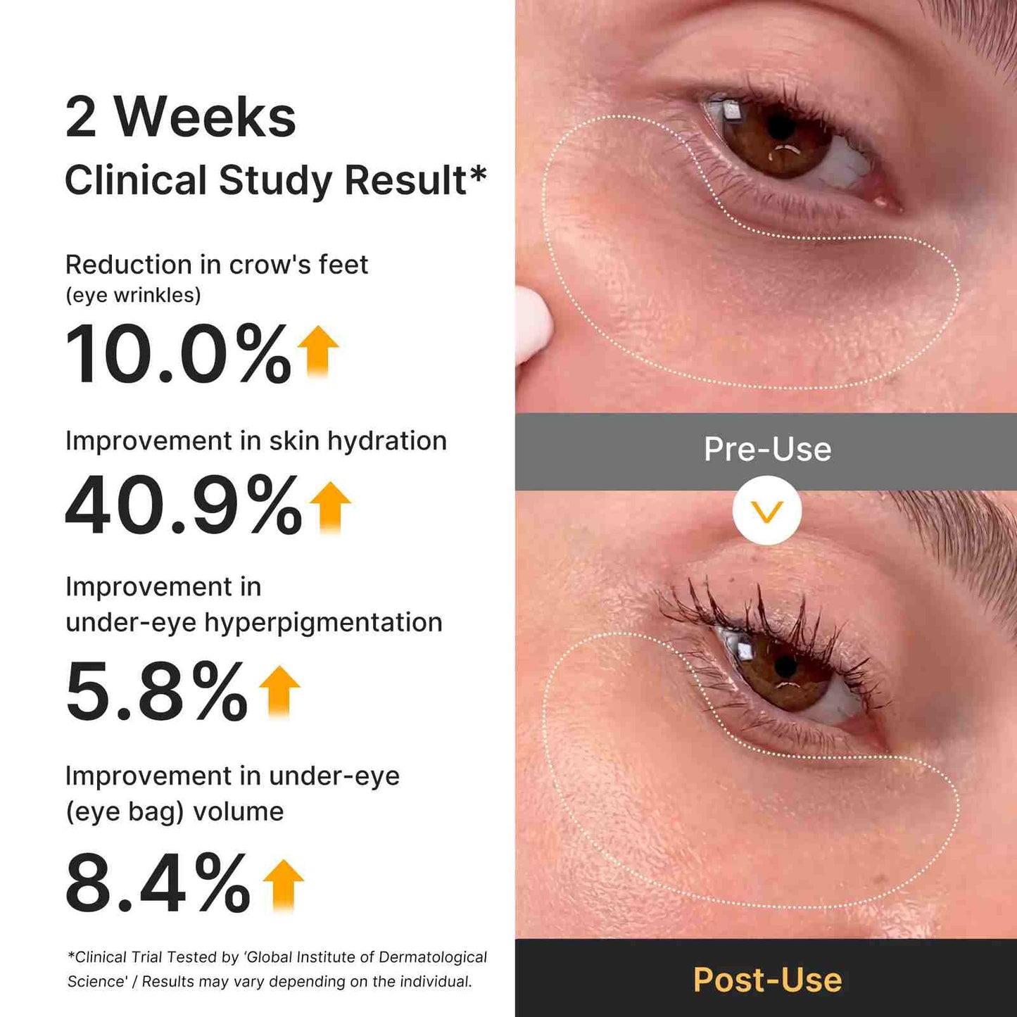 Kojic Acid & Turmeric Hydrogel Eye Patches