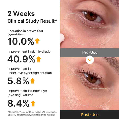Kojic Acid & Turmeric Hydrogel Eye Patches
