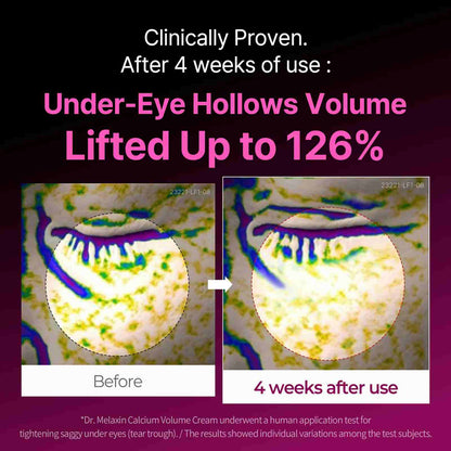 Calcium Eye Cream – Firming & Wrinkle Repair