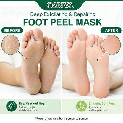 [BUY 1 GET 1 FREE] Baby-Soft Feet in Days with Ultimate Exfoliating Foot Peel Mask