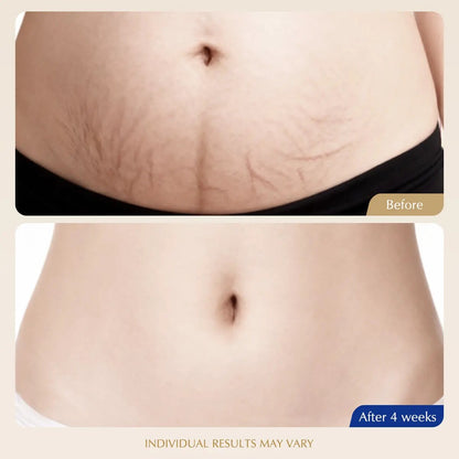 [BUY 1 GET 1 FREE] 15-Day Fast-Acting Cryo-Thermo Gold Sculpting Cream