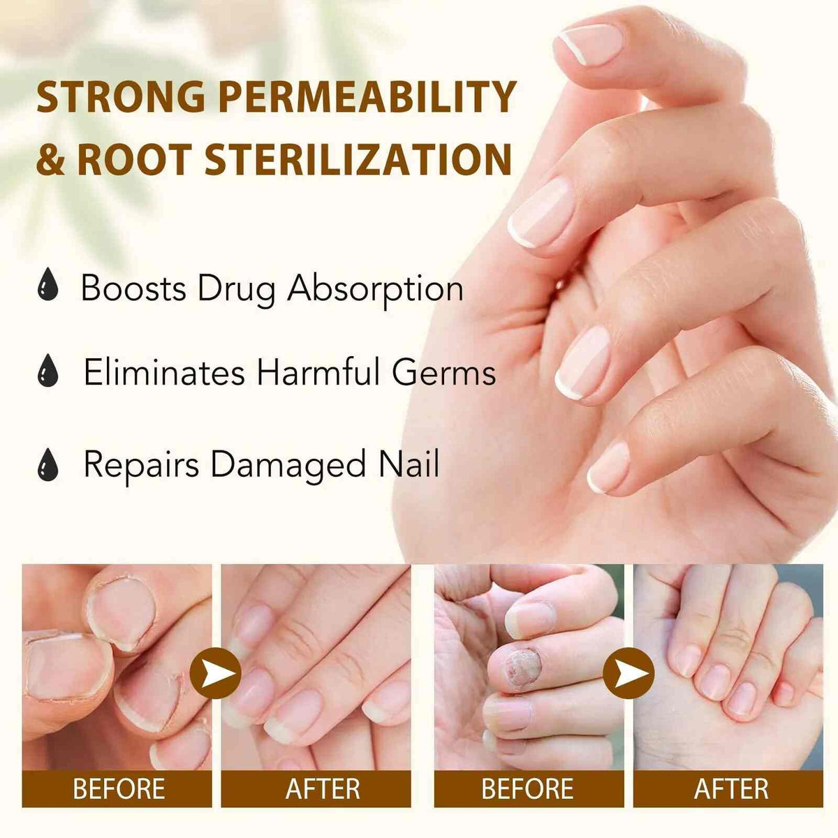 [BUY 1 GET 1 FREE] All-Natural Plant Nail Repair Treatment Liquid