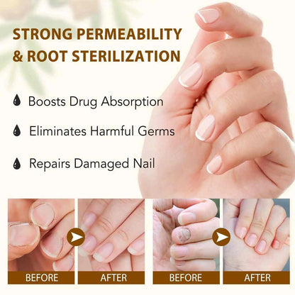 [BUY 1 GET 1 FREE] All-Natural Plant Nail Repair Treatment Liquid