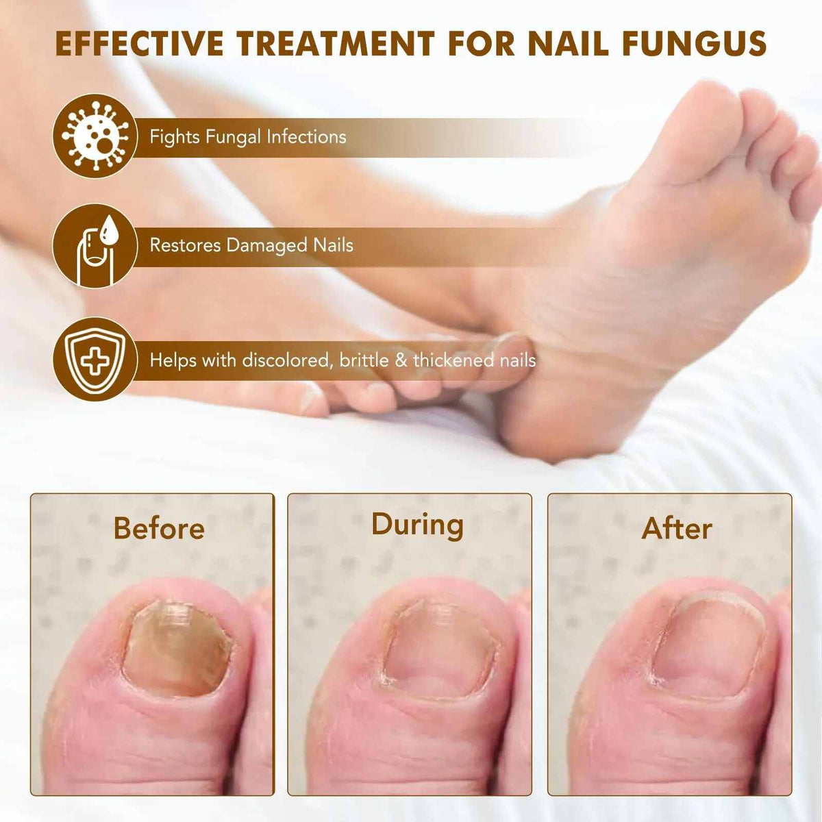 [BUY 1 GET 1 FREE] All-Natural Plant Nail Repair Treatment Liquid