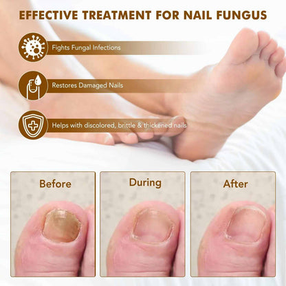 [BUY 1 GET 1 FREE] All-Natural Plant Nail Repair Treatment Liquid