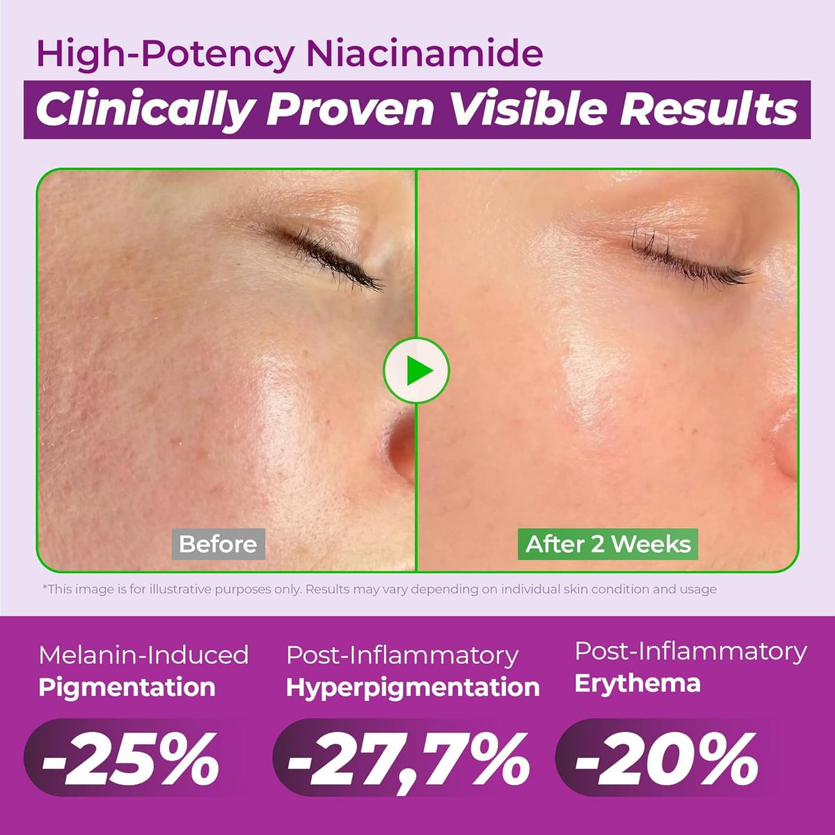 [BUY 1 GET 1 FREE] Helps improve dullness, spots, redness, and visible pores.