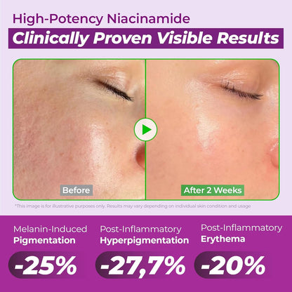 [BUY 1 GET 1 FREE] Helps improve dullness, spots, redness, and visible pores.