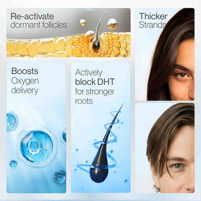 Thicker, Denser Hair: 5% Saw Palmetto & Rosemary Roll-On Scalp Serum