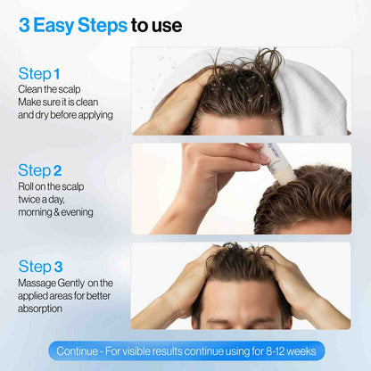 Thicker, Denser Hair: 5% Saw Palmetto & Rosemary Roll-On Scalp Serum