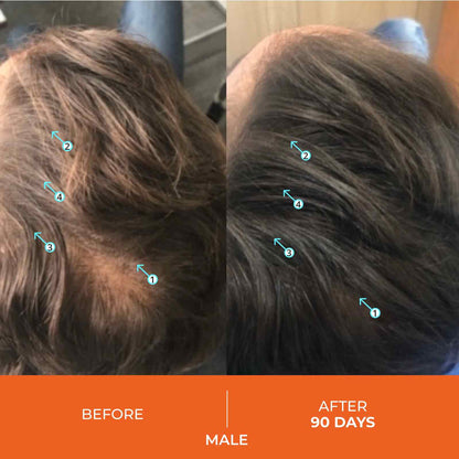Revitalizing Hair Growth Stimulating Shampoo