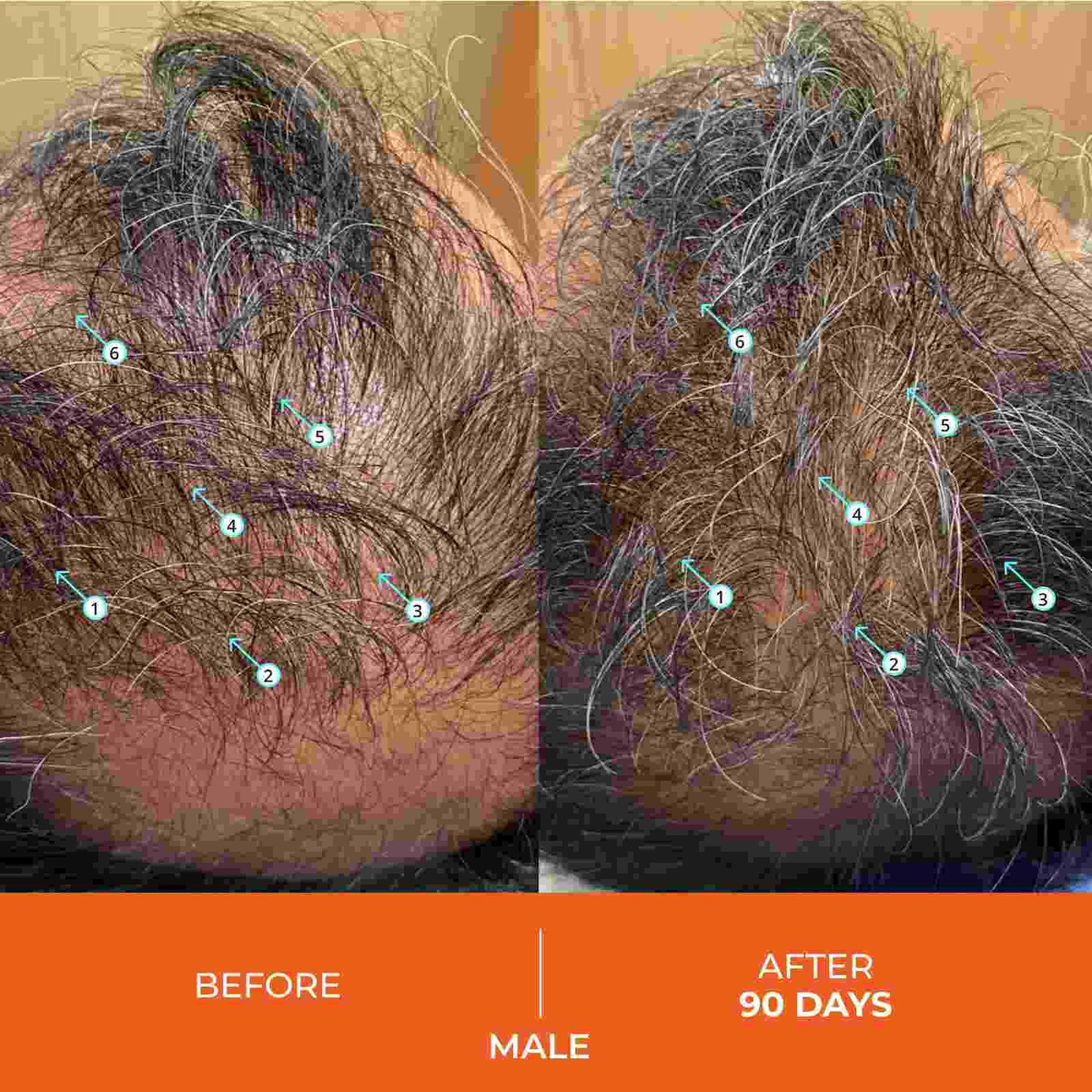 Revitalizing Hair Growth Stimulating Shampoo