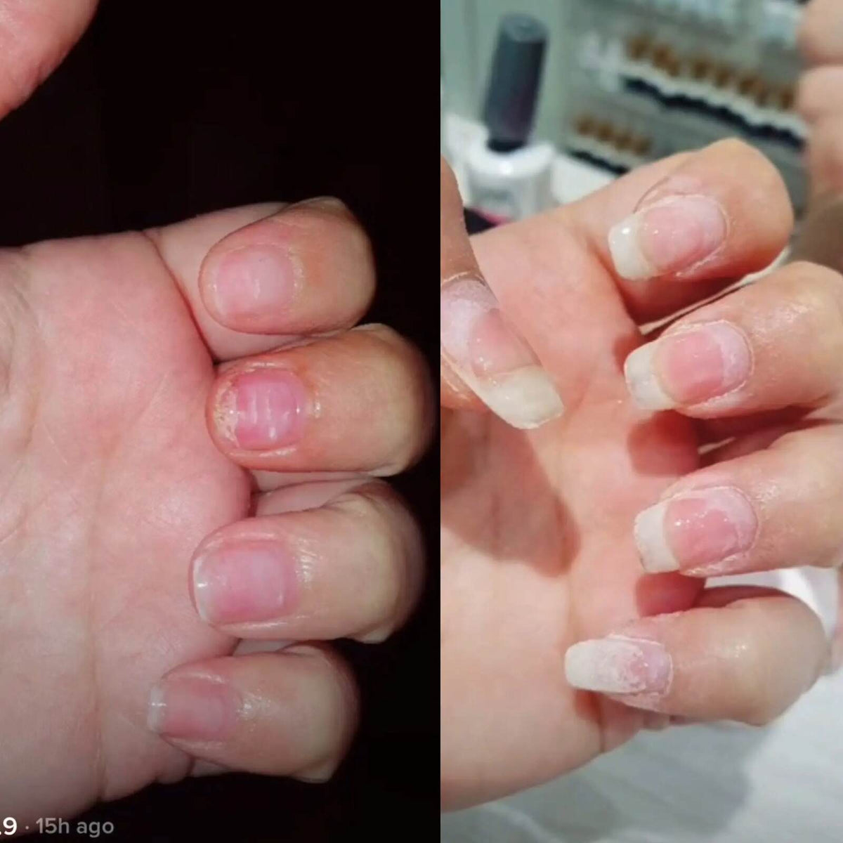 Rapid Nail Growth & Repair Oil: Stronger, Longer, Healthy Nails in Days
