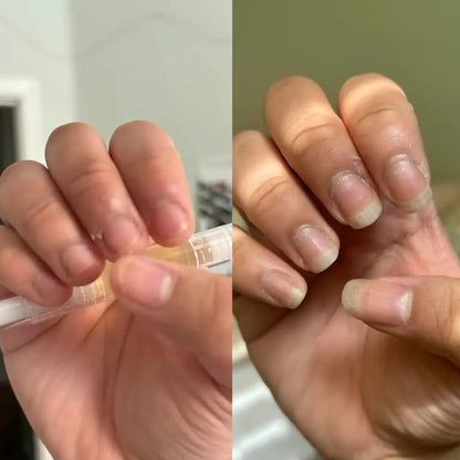 Rapid Nail Growth & Repair Oil: Stronger, Longer, Healthy Nails in Days
