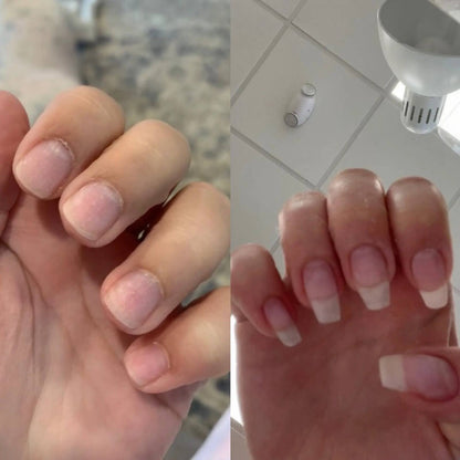 Rapid Nail Growth & Repair Oil: Stronger, Longer, Healthy Nails in Days