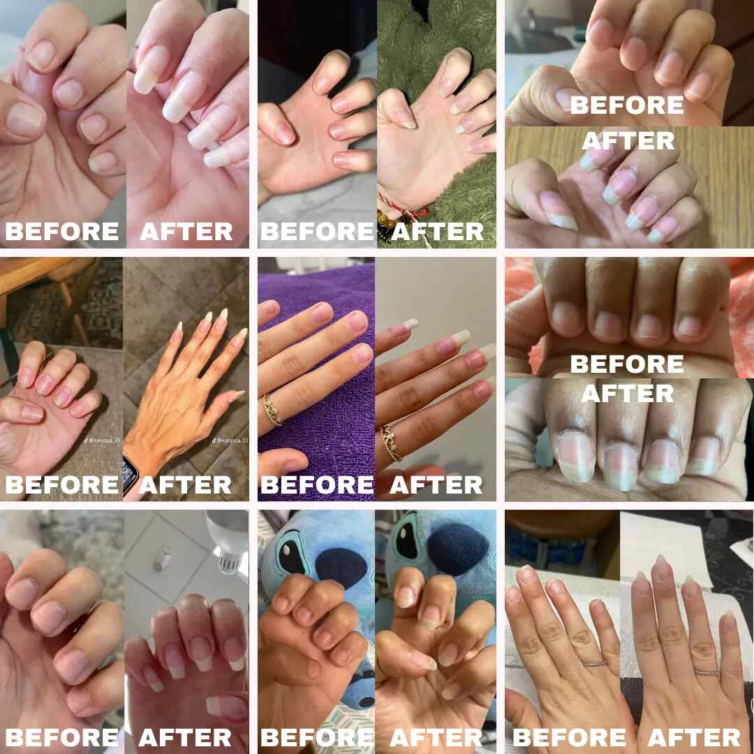 Rapid Nail Growth & Repair Oil: Stronger, Longer, Healthy Nails in Days