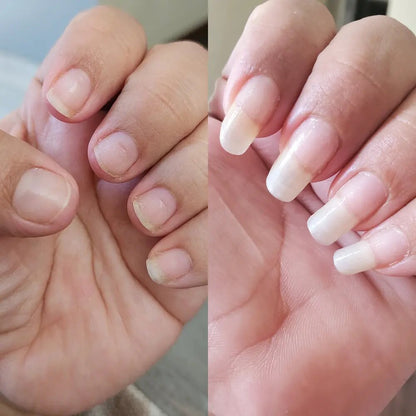 Rapid Nail Growth & Repair Oil: Stronger, Longer, Healthy Nails in Days