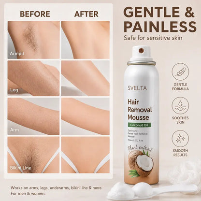 SilkEase Bikini Hair Removal Kit – Gentle Cream & Mousse with Aloe & Coconut Oil